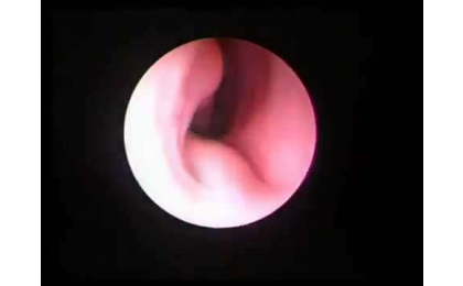 geniz-eti-cem-erdurak